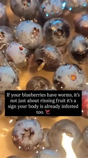 57 reactions · 22 shares | 𢡄缾 The Truth About Worms in Your...