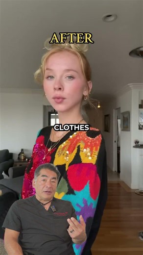 This chin transformation is unreal
