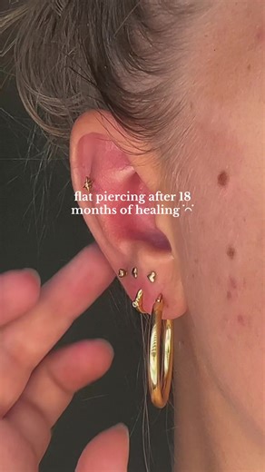 Complete Guide to Healing a Flat Piercing