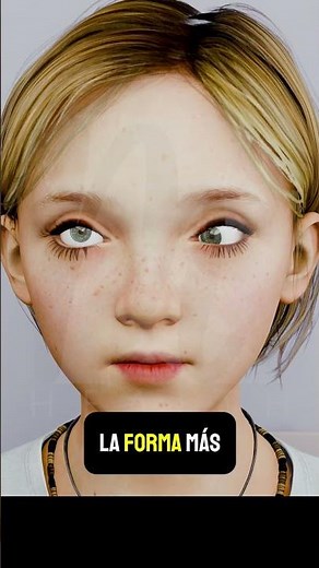 Never rub your eye! 👁️😨 The safe trick to get something out