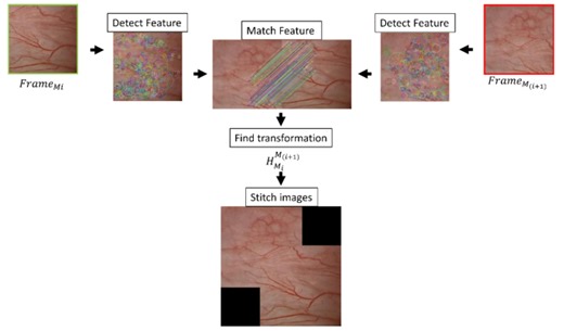 Bladder image stitching algorithm for navigation and referencing using a standard cystoscope - Scientific Reports