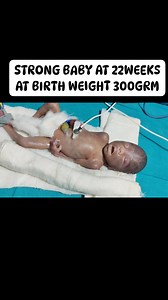 130K views · 2.2K reactions | At Newborn baby, 22 weeks gestation at birth, weighs 300 grams and is admitted to NICU care for intensive care #atbhirth #weightcheckbaby #afterbhirth #cutebaby #newborn #fblifestyle #afterbirth #babybathtime #babyhealth | Little Angel Care | Facebook