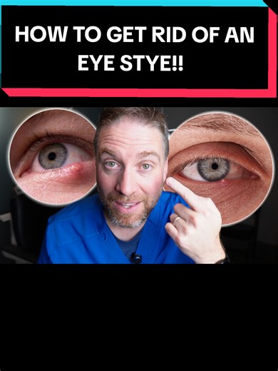 Effective Ways to Treat an Eye Stye