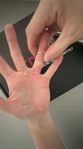 Hope you never need it..but it works when it counts✂️ #GearTest #RingCutter #MedicBox #SavedTripToTheER | MedicBox