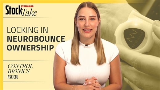 StockTake: Control Bionics