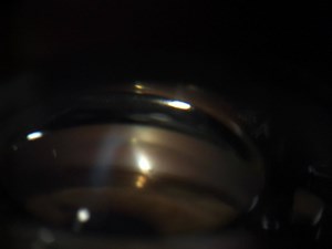 6 comments | Glaucoma Guru on Reels | Facebook