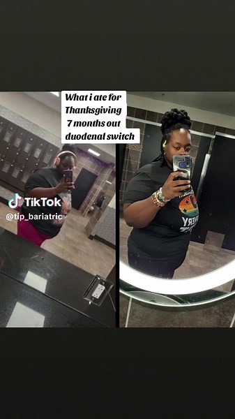 This my first thanksgiving after surgery my stomach did really good with the foods I ate I had two bites of cake to😆 #duodenalswitch #thanksgiving #thanksgivingdinner #bariatricsurgery #postop #vsgcommunity