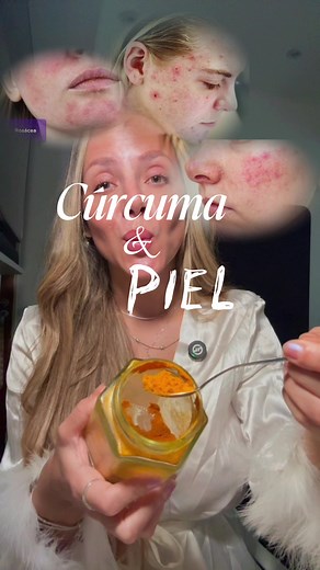 . Seguro que esto no lo sabías! Como preparar la cúrcuma para tratar tu piel en tu casa. Potente antiinflamatorio - antioxidante de milenios, y hoy te cuento cómo hacerla 👉🏻. Disfruta del vídeo ❤️ Y contame si sabías esto o si lo hacías ya en tu casa?