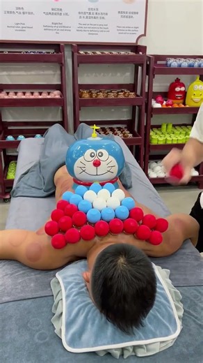 Amazing Cupping Therapy Session 😮 | Traditional Chinese Medicine & Healing Technique