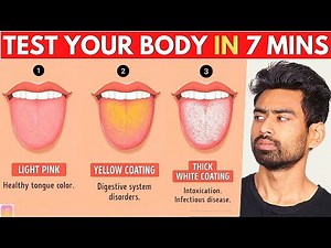 31 Tongue Signs Your Body is Asking for Help (With Solutions)