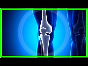 5 symptômes du cancer des os primaire à connaître