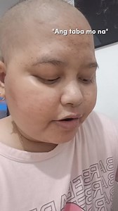 135K views · 1K reactions | Sorry po Hiyang po ata sa chemo meds  | Donna Jean | Facebook