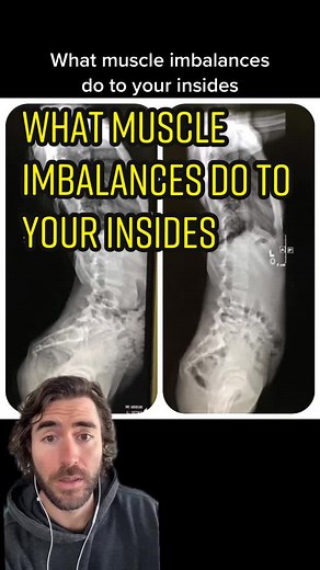 Correcting Muscle Imbalances for Pain and Injury Relief