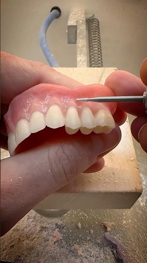Denture manufacturing process.