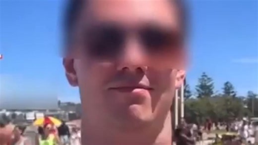 Pharyngocèle : surnommé “frog throat” (gorge de crapaud 🐸) ou “neck puff” (gonflement du cou). Souvent observé chez les trompettistes 🎺 ou dans les métiers générant une forte pression intra-orale et intra-thoracique, comme les souffleurs de verre #medicine #medicalstudent #diagnosis #medlife #health #anatomy #radiology #pathology #humanbody #hospital #doctor #medschool #medecine #sante #anatomie #corpshumain #hopital #docteur #edn | Tout savoir sur la Médecine