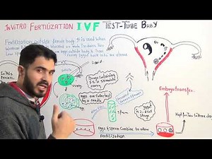 L-10 Test Tube Baby In-vitro Fertilization Mechanism and procedure By Dr A.hadi