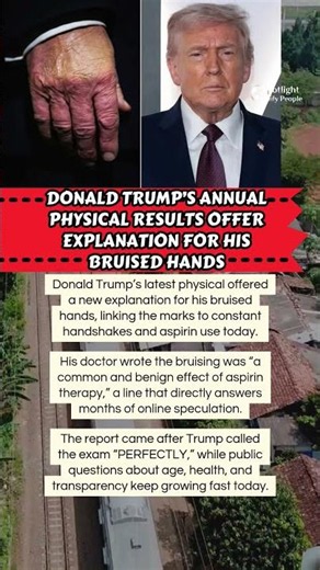 Trump’s Bruised Hands Explained 🩺