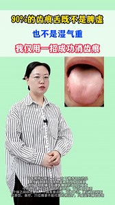 90%的齒痕舌，既不是脾虛也不是濕氣重，一招成功消 #抖出健康知識寶藏#熱點#舌象#真實生活分享計劃 | 芥末鱼皮
