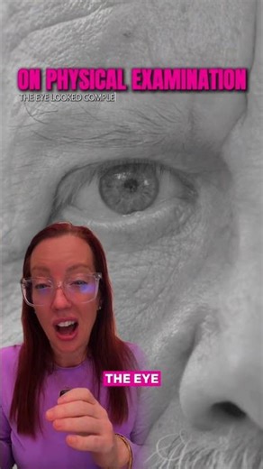 Case study 225 – painless vision loss. What do you think is the diagnosis? #sundaycasestudy