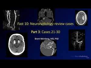 Fast 10: Neuroradiology high speed case review part 3 - Cases 21-30