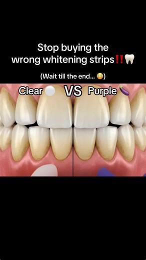 Surprising Results of Teeth Whitening Strips