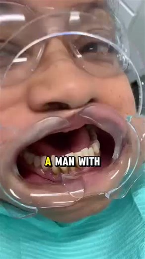 Reverse Bad Breath and Tooth Decay with Dental Gum