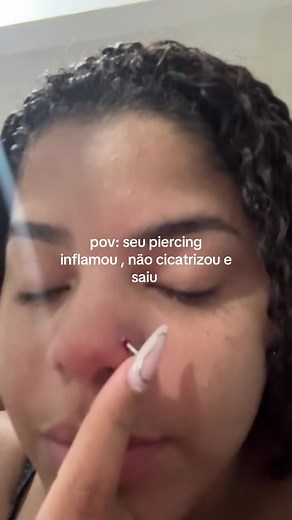 Meu Piercing Inflamou: Dicas de Cuidado e Cicatrização