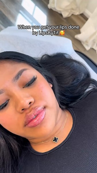 Come find me in the DMV area and get your perfect pout 💋 Whether you want natural or dramatic lips, I’m here to help 💕 DM me on IG! #lipfiller #aesthetic #dmv #nurseinjector #beauty