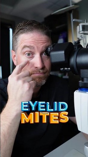 This Is What Eyelid Mites Look Like! (Demodex)