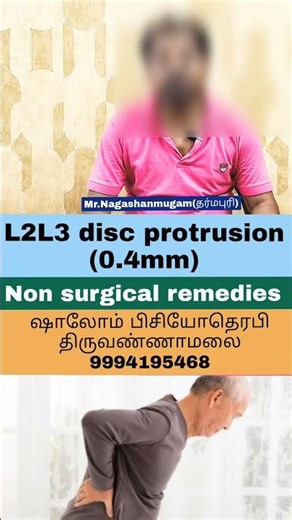 L2L3 disc protrusion, dehydration (0.4mm) || Saving without surgery