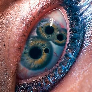 25K views · 552 reactions | What happens to your body when you're exposed to radiation? #WhatIf | What If | Facebook