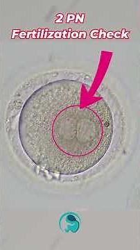 What is ICSI? Step-by-Step Fertility Procedure Explained by an Embryologist