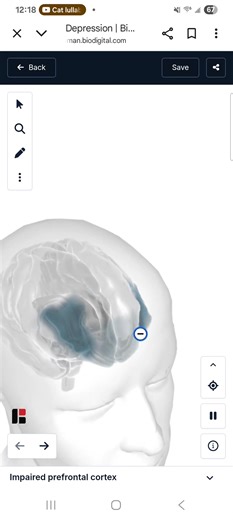 This is your brain when suffering from depression. Your prefrontal cortex is responsible for things like •concentration •Impulsivity •Emotional stability •personality •decision-making If you or someone you know is suffering from depression please get yourself or them help. God bless you and stay healthy  ✨️ #futureDrcrawford | Kristin Paige | Facebook