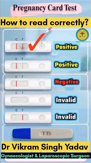  HOW TO READ A PREGNANCY TEST KIT LIKE A PRO! 擄✨ (Trust me, it’s...