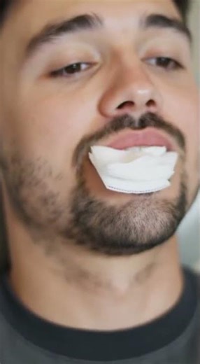 🦷 Bleeding After Tooth Extraction — Is It Normal?