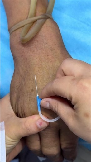 How to Give IV Inyección, Intravenous IV & IM Inyección | Step-by-step Intravenous IV technique: N53