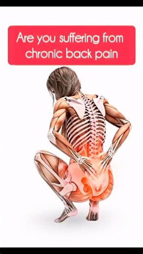 The Only 6 Exercises You Need to Fix Your Back Pain✨🧘‍♀️#shorts#backpain#youtube#ytshorts#selfcare
