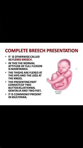 BREECH PRESENTATION TYPES #nursing #midwife #medicine #nursingstudents #nursingofficer
