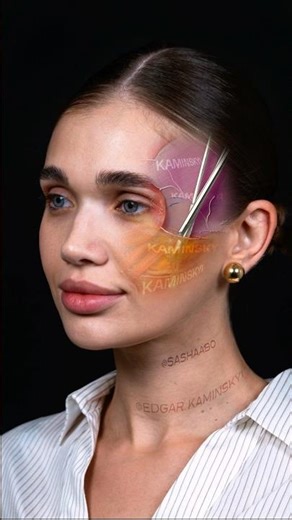 Endoscopic face lift, rhinoplasty, lip lift, eyelid surgery ⭕️ KAMINSKYI