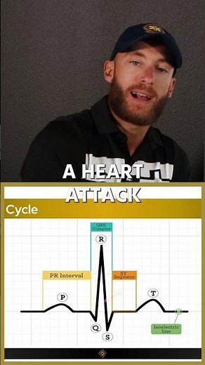 The ECG Detail That Changes Everything