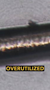 25 reactions | The Limitations of Hair Analysis for Nutritional Assessment #hairanalysis #nutrition #overutilized #nutritiontesting | Dr. Peter Osborne | Facebook
