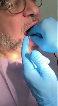 Upper & lower suction and an initial set of dentures by Dimitry Shmitsman, RD. CDT.