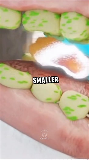 Chew Right, Digest Better! 🦷🥗 #dentaltips