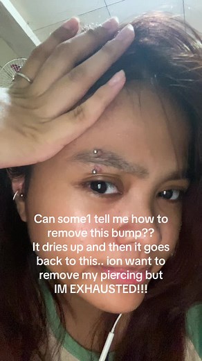 How to Deal with Eyebrow Piercing Bumps Effectively