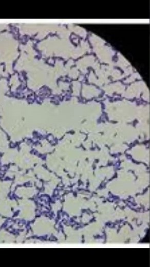 Lactobacillus acidophilus under Microscope #Lacticacid #bacteria #rodshape #biotechnology