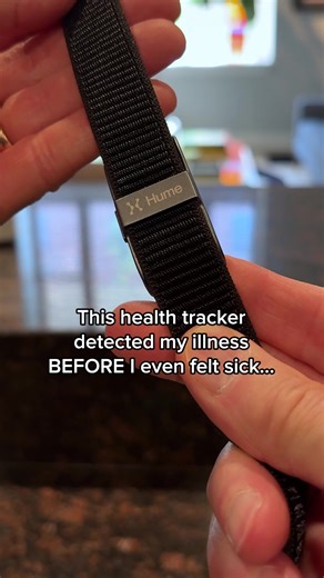 Meet the AI-powered wearable over 1.2 million users rely on 👀 Hume Band continuously scans your biomarkers, catches health issues early, and guides you to smarter choices for a longer life. 🎯 Increase energy, endurance, and resilience 🏆 Detect health issues before symptoms show 📱 AI-driven personalized health routines 🩺 Comfortable, wearable 24/7 👉 Click now to get 40% OFF free shipping for a limited time only! | Hume Health