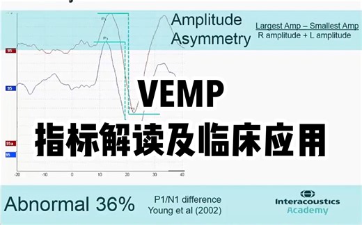 VEMP ②如何解读VEMP的幅度、阈值和刺激声频率，VEMP临床应用| VEMP 前庭诱发肌源性电位| 油管搬运|双语字幕