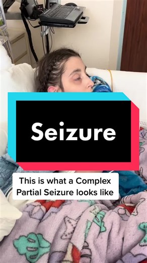 Understanding Epilepsy Seizures: A Personal Account