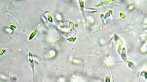 4.5K views · 22 comments | Researchers say the 'worrisome' findings may have serious implications for fertility and men's health For more: https://youtu.be/MfS0oCqDm64 | CBC News: The National | Facebook