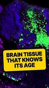 This Lab-Grown Brain Tissue Knows Its Age